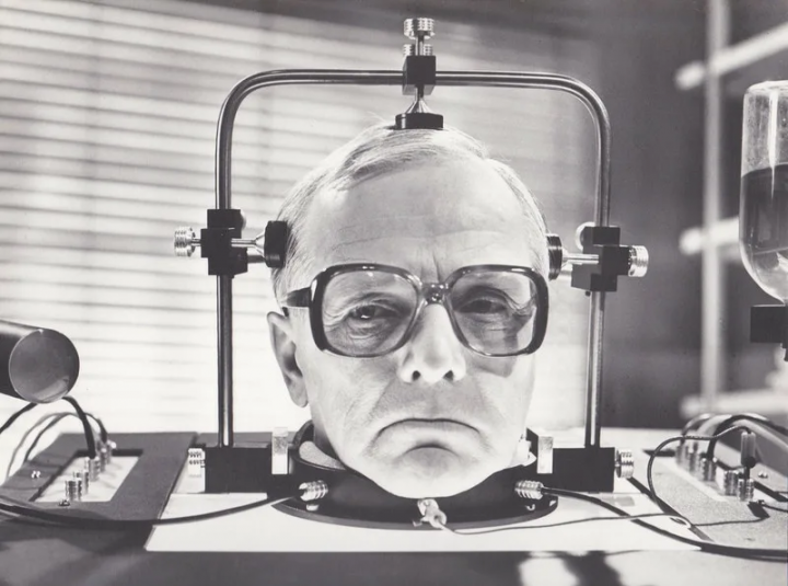 «Голова профессора Доуэля»: чем закончился реальный советский эксперимент по пересадке головы