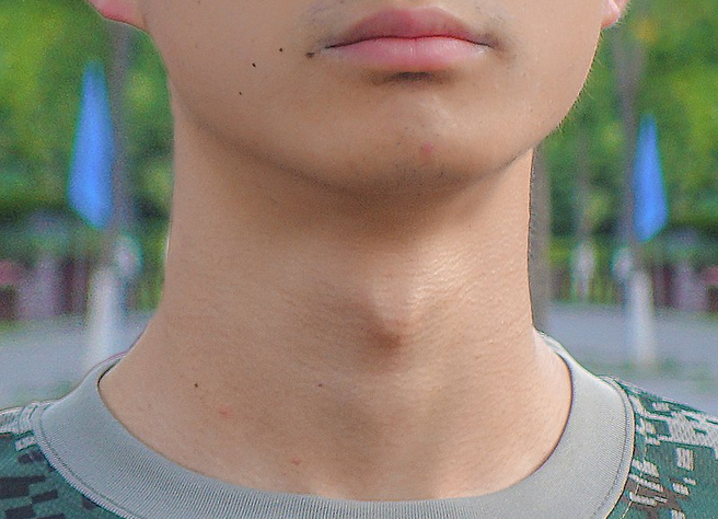 Для чего мужчине нужен кадык